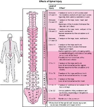 omurganın farklı bölgelerine verilen hasarla ilişkili vücuttaki hastalıklar