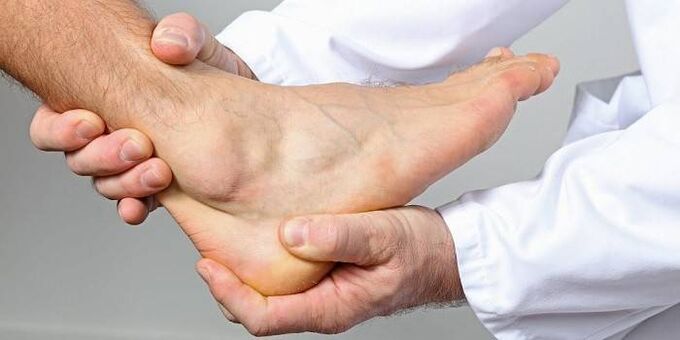 ayak bileği artrozu için uzman muayenesi