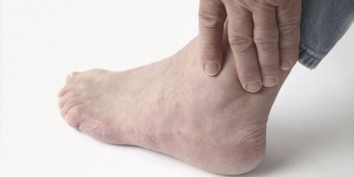 ayak bileği artrozunda ağrı