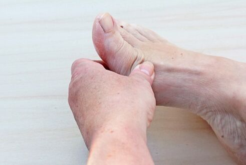ayak artrozu